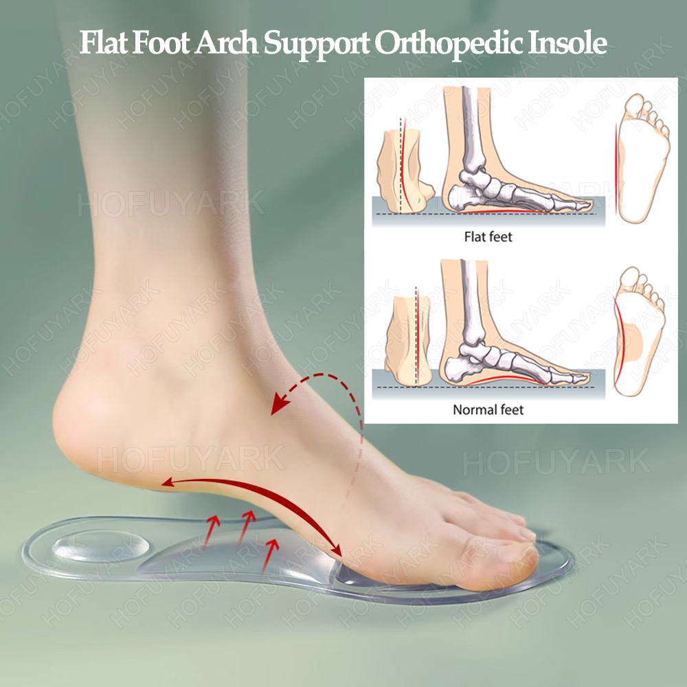 Plantillas de Gel de silicona  - Women'S Shoes High Arch Support reseña y precio
